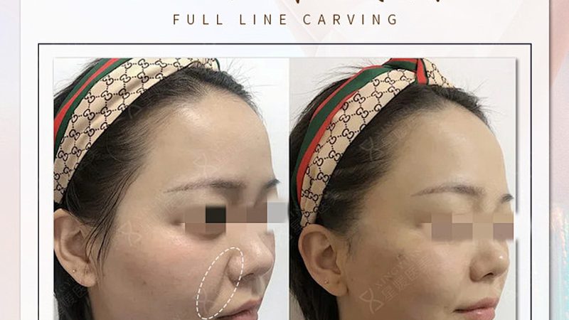 成都医美医院排名榜：揭秘优质医美机构的选择标准