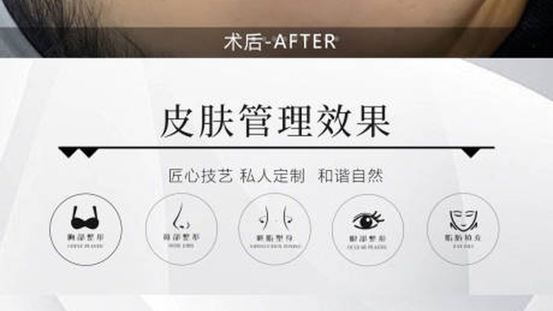 医用激光祛斑仪器定制，如何选择合适的产品？**