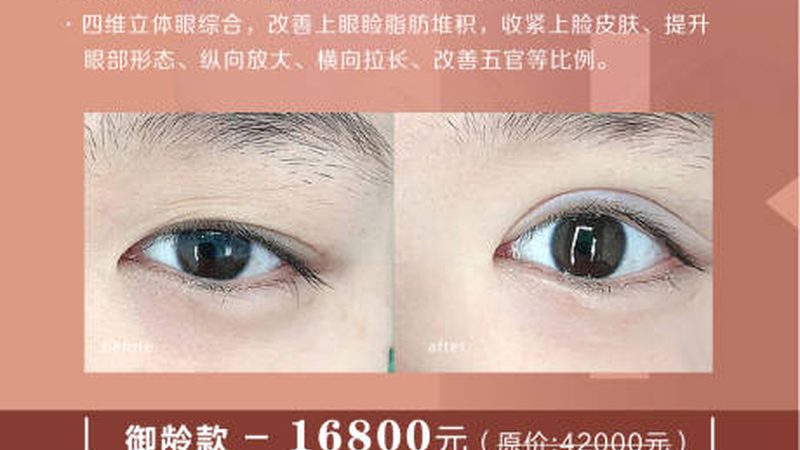 上海激光美容术前准备注意事项