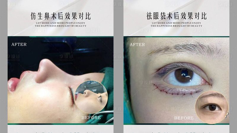 小标题：了解面部提升与填充
