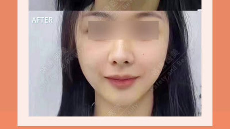医美咨询师加盟注意事项