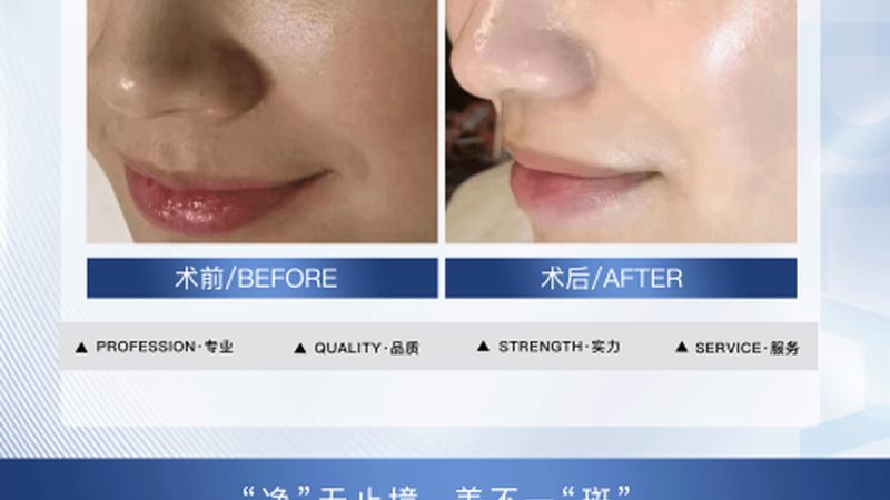 注射美容不适合哪些人