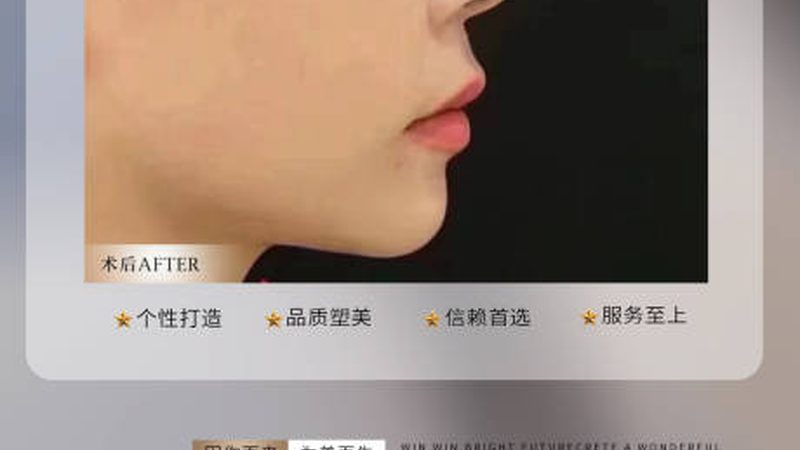 激光脱毛：揭秘为何需要多次才能达到理想效果