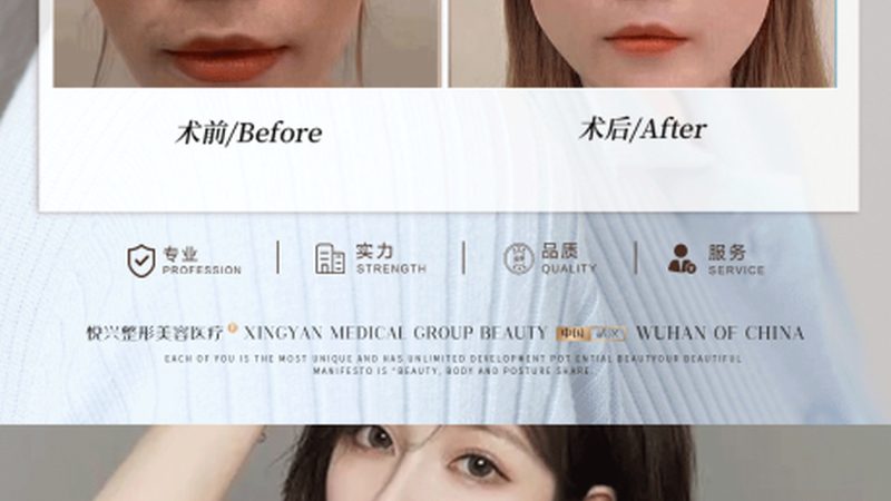 医美咨询师培训，开启你的美丽事业新篇章