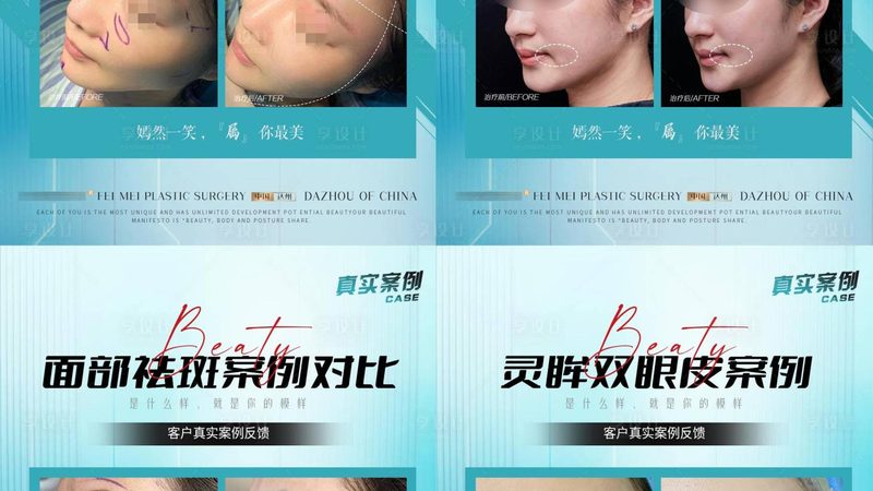 整形医院加盟，总部扶持政策揭秘