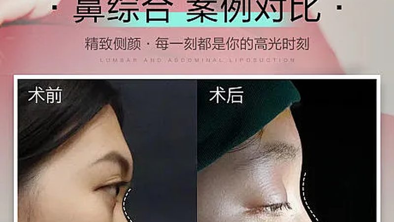 敏感肌适用家用光子嫩肤仪吗？揭秘家用光子嫩肤仪的真相