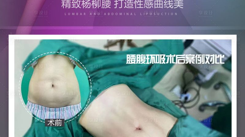 面部抗衰医美项目排名前十