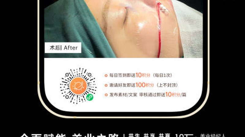 玻尿酸填充面部哪个牌子好步骤