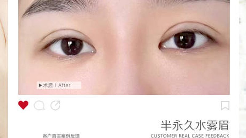 玻尿酸品牌规格参数对比