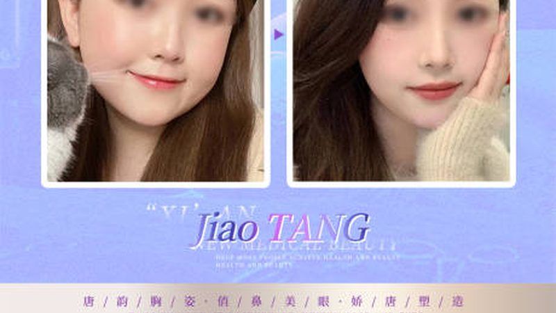 膨体隆鼻术前，你准备好了吗？**