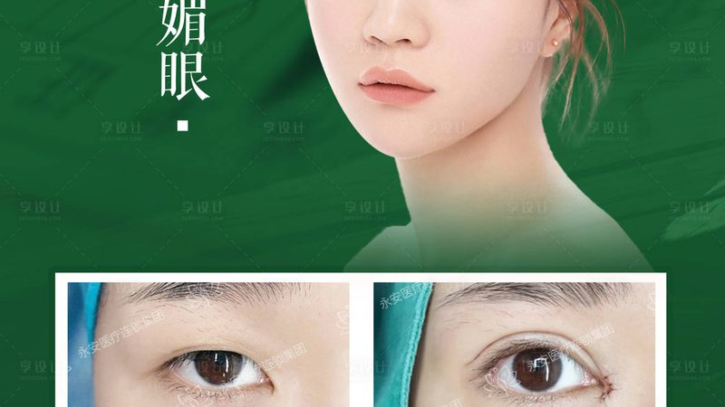 热玛吉术后护理：全身与面部的差异解析