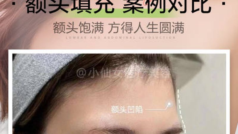 永久脱毛，真的有效吗？揭秘脱毛技术的真相**